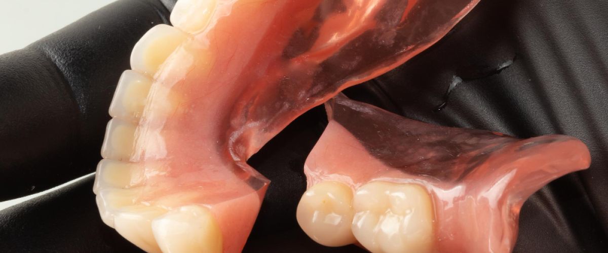 broken denture in the hand of a dental surgeon wearing black rubber gloves